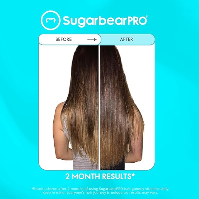SugarBearPro Hair Vitamin Gummy 2 Month Supply & 1 Pure Batana Natural Hair Growth Oil-Extra Strength Biotin 6000mcg, Women, Men, Vegan Vitamin B12, MSM, Inositol, Elderberry, Kosher