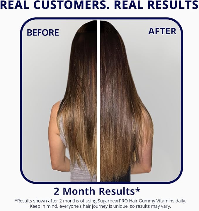 Sugarbear Hair Vitamin Gummy 2 Month Supply Extra Strength Biotin 6000mcg, Growth for Men & Women, Vegan Vitamin B12, MSM, Inositol, Omega 3, Elderberry, Certified Kosher, Halal, Cruelty-Free