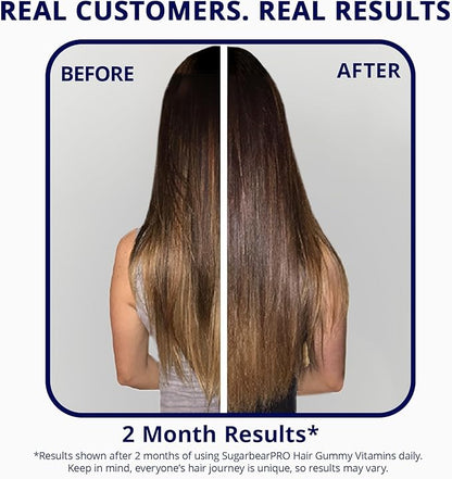 SugarBearPro Hair Vitamin Gummy 1 Month Supply Extra Strength Biotin 6000mcg, Growth for Men & Women, Vegan Vitamin B12, MSM, Inositol, Omega 3, Elderberry, Certified Kosher, Halal, Cruelty-Free
